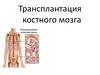Трансплантация костного мозга