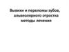 Вывихи и переломы зубов, альвеолярного отростка. Методы лечения