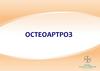 Остеоартроз. Клиника остеоартроза. Методы лечения