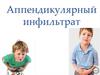 Аппендикулярный инфильтрат
