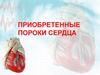 Приобретенные пороки сердца