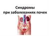 Основные синдромы при заболеваниях почек