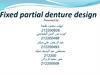 ‫‪Fixed partial denture design‬‬