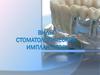 Виды стоматологических имплантов
