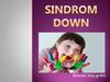 Sindrom Down