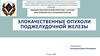 Злокачественные опухоли поджелудочной железы