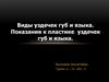 Виды уздечек губ и языка. Показания к пластике уздечек губ и языка