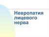 Невропатия лицевого нерва