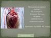 Врожденные пороки сердца