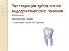 Реставрация зубов после эндодонтического лечения
