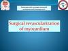 Surgical revascularization  of myocardium