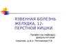 Язвенная болезнь желудка, 12-перстной кишки