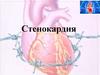Стенокардия