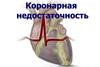 Коронарная недостаточность