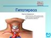 Гипотиреоз. Анатомия щитовидной железы