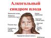 Алкогольный синдром плода