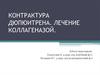 Контрактура дюпюитрена. Лечение коллагеназой