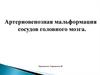 Артериовенозная мальформация сосудов головного мозга