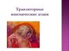 Транзиторные ишемические атаки