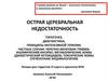 Острая церебральная недостаточность