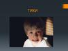 Тики (тикозные гиперкинезы)