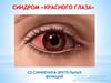 Синдром «красного глаза» со снижением зрительных функций