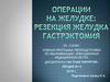 Операции на желудке: Резекция желудка. Гастрэктомия