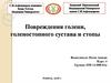 Повреждения голени, голеностопного сустава и стопы