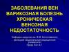 Заболевания вен. Варикозная болезнь. Хроническая венозная недостаточность