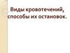 Виды кровотечений, способы их остановок
