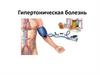 Гипертоническая болезнь
