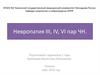 Невропатия III, IV, VI пар глазодвигательного нерва (ЧН)