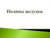 Полипы желудка