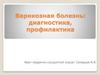 Варикозная болезнь: диагностика, профилактика