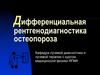 Дифференциальная рентгенодиагностика остеопороза