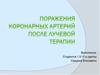 Поражения коронарных артерий после лучевой терапии