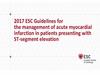 2017 ESC Guidelines for the management of acute myocardial infarction in patients presenting with ST-segment elevation