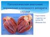 Патологическая анатомия поражения клапанного аппарата сердца