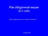 Рак ободочной кишки (C-r coli)