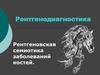 Рентгенодиагностика. Патология костно-суставной системы. Лекция 2