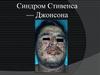 Синдром Стивенса — Джонсона