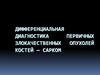 Дифференциальная диагностика первичных злокачественных опухолей костей — сарком
