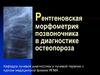 Рентгеновская морфометрия позвоночника в диагностике остеопороза