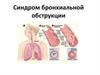 Синдром бронхиальной обструкции