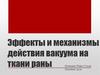 Эффекты и механизмы действия вакуума на ткани раны