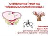 Аномалии таза (Узкий таз). Неправильные положения плода