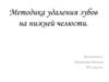 Методика удаления зубов на нижней челюсти