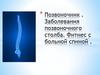 Позвоночник. Заболевания позвоночного столба. Фитнес с больной спиной