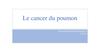 Le cancer du poumon
