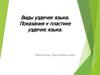 Виды уздечек. Показания к пластике уздечке языка
